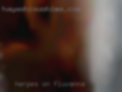 Herpes on a black men fucked woman in Fluvanna.